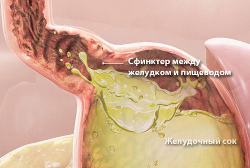 Шта урадити ако имате опекотине